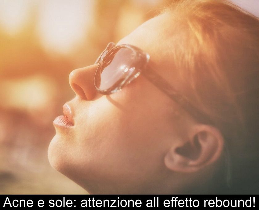 Acne E Sole: Attenzione All'effetto Rebound!