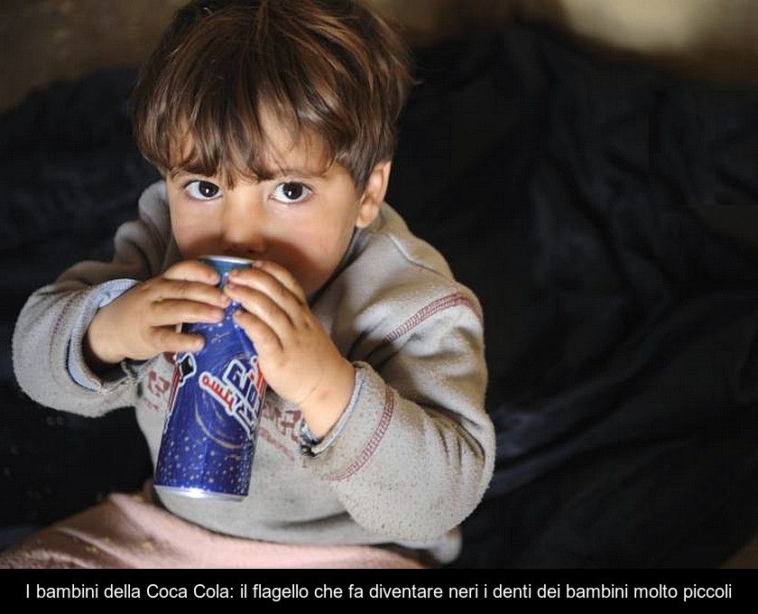 I Bambini Della Coca Cola: Il Flagello Che Fa Diventare Neri I Denti Dei Bambini Molto Piccoli