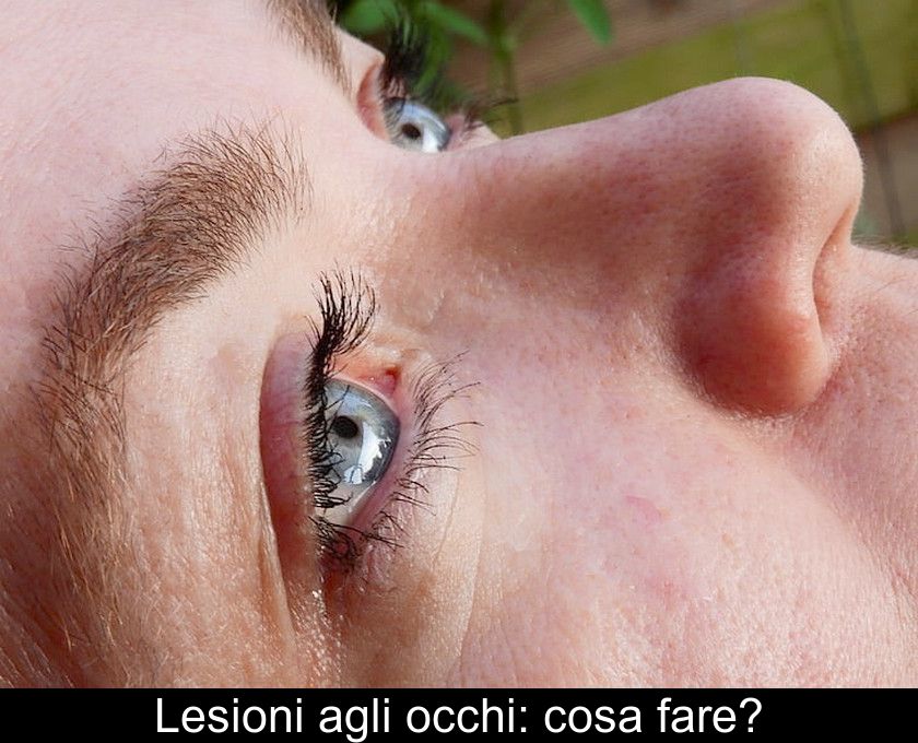 Lesioni Agli Occhi: Cosa Fare?