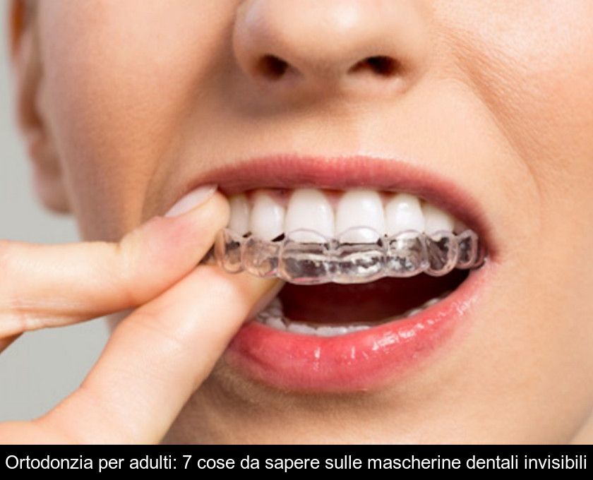 Ortodonzia per adulti: 7 cose da sapere sulle mascherine dentali invisibili