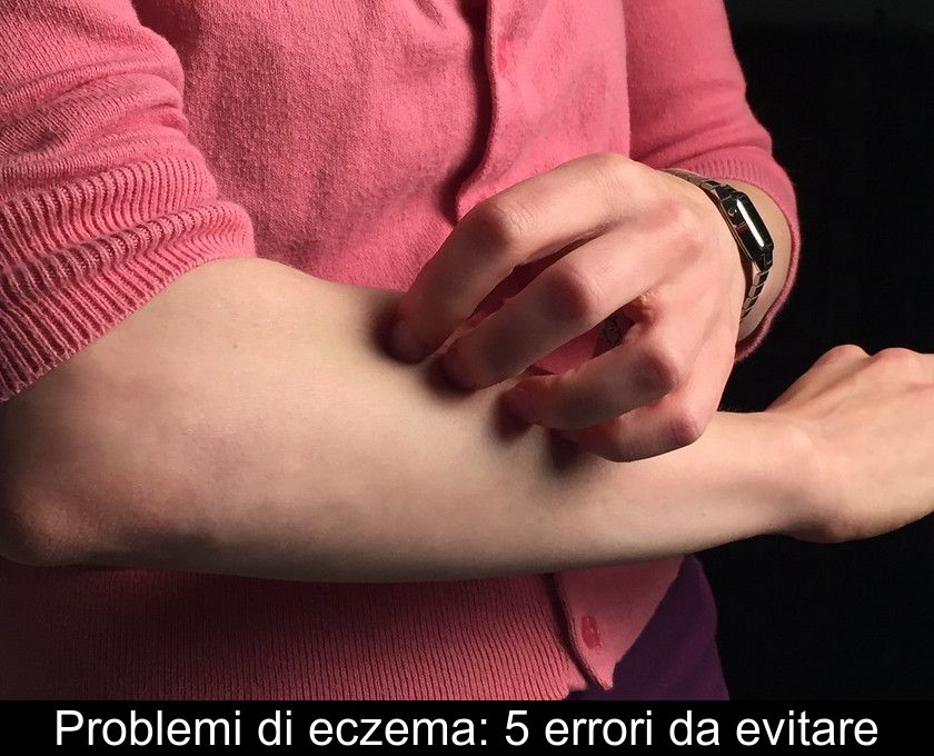 Problemi Di Eczema: 5 Errori Da Evitare