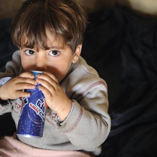 I bambini della Coca Cola: il flagello che fa diventare neri i denti dei bambini molto piccoli